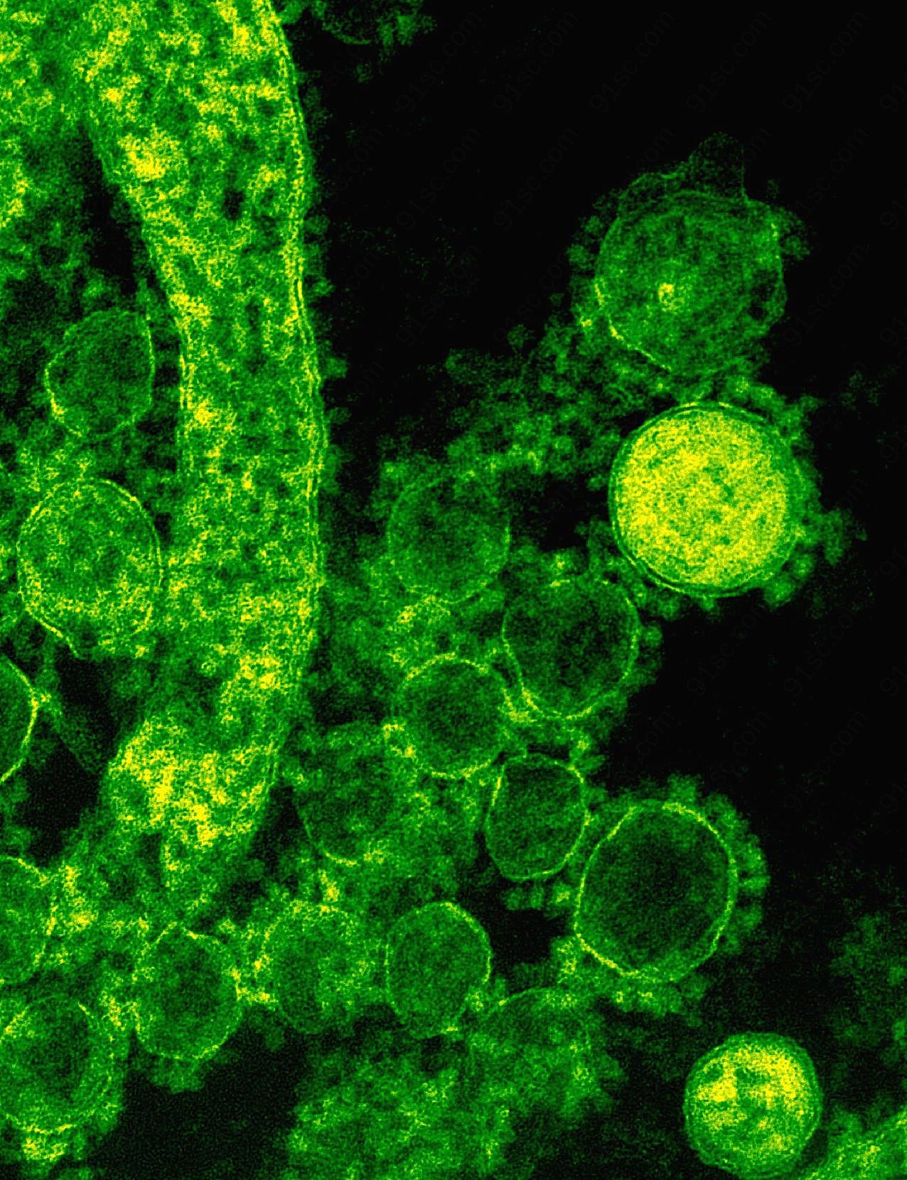 显微镜下的细菌图片高清科技