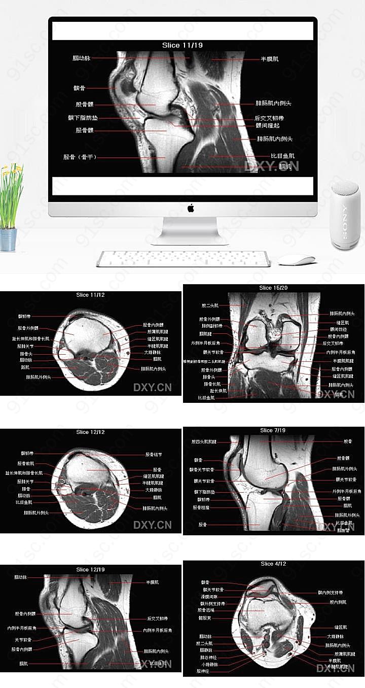 膝部MRI解剖课件